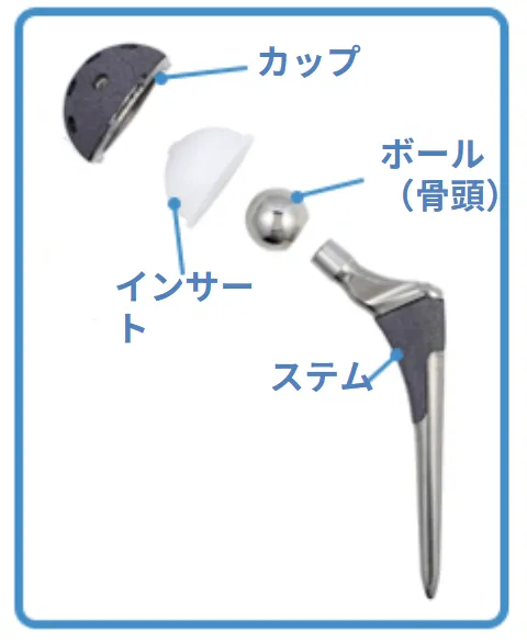 人工股関節置換術について_はちや整形外科病院